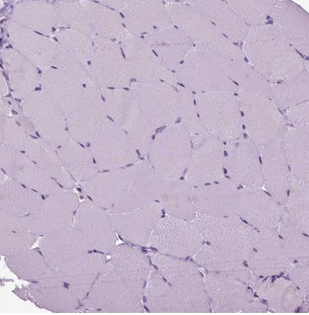RFX3 Antibody