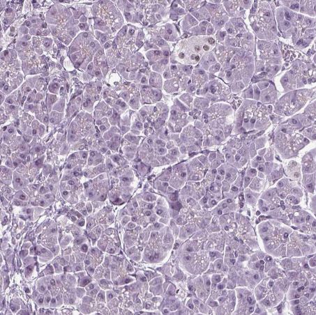 RFX3 Antibody