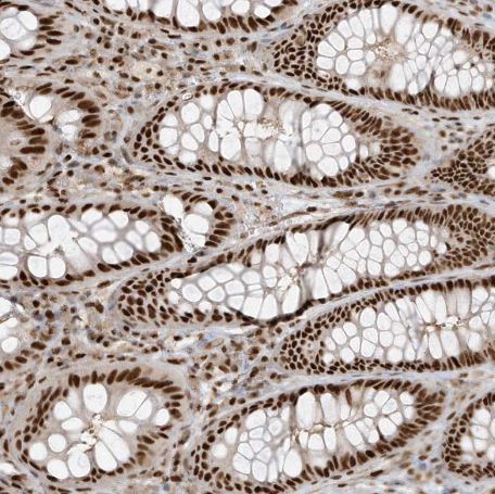 CKS2 Antibody