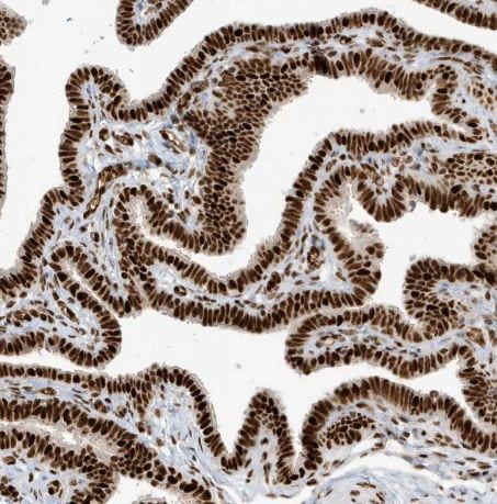 CKS2 Antibody