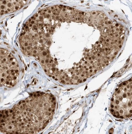 CKS2 Antibody