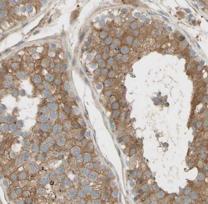 TACE/ADAM17 Antibody