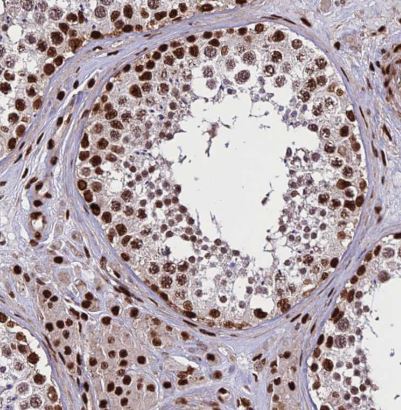 INO80E Antibody