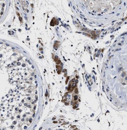 Cav1.3 Antibody