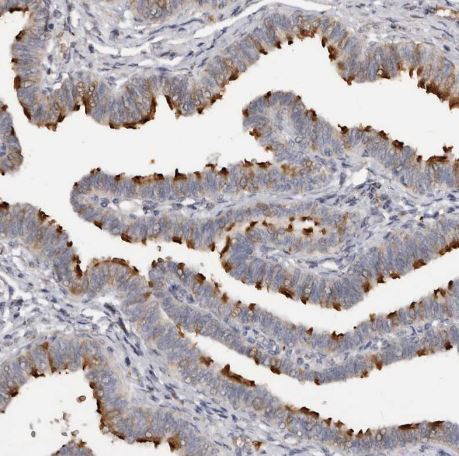 FAM189A2 Antibody