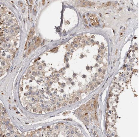 FAM189A2 Antibody
