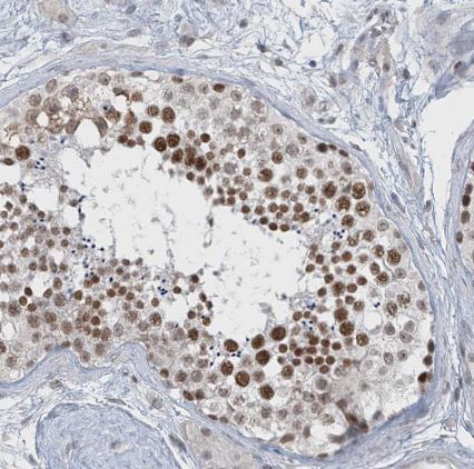 MCM9 Antibody
