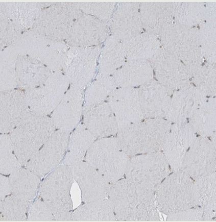 MCM9 Antibody