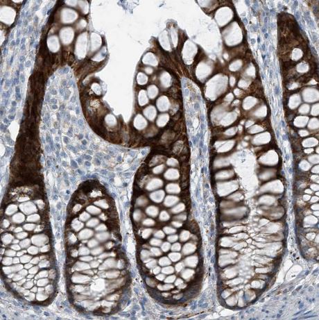 FAM162A Antibody