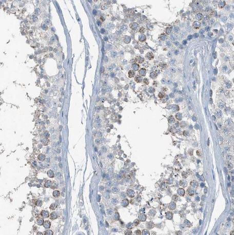 FAM162A Antibody