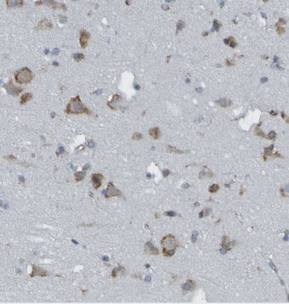TRAP alpha Antibody