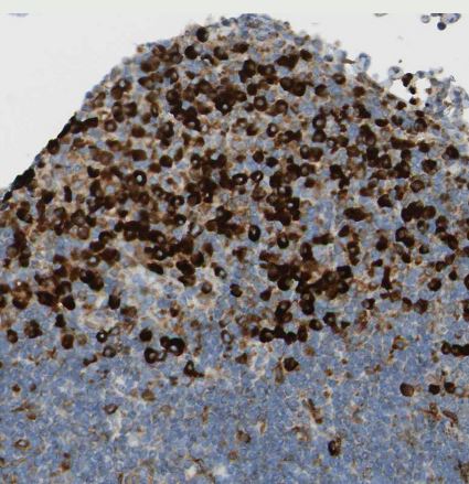 TRAP alpha Antibody