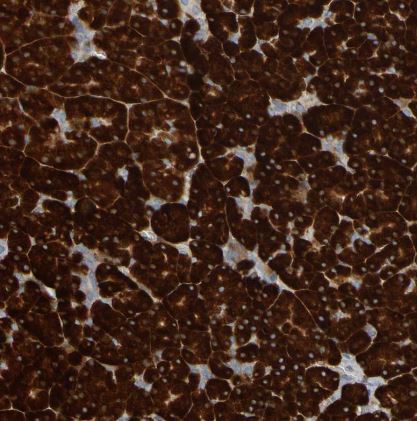 TRAP alpha Antibody