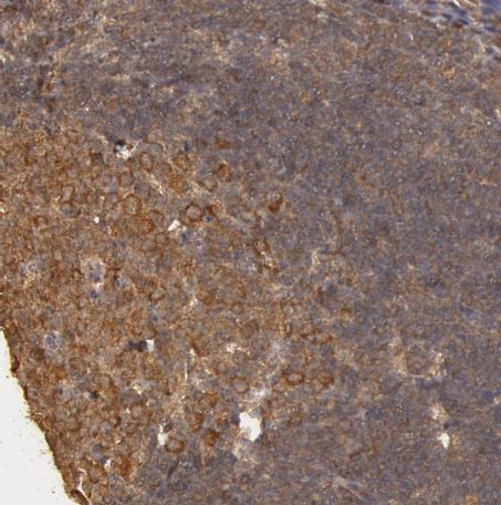 USP14 Antibody