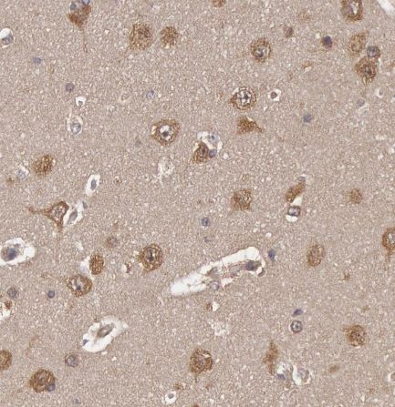 USP14 Antibody