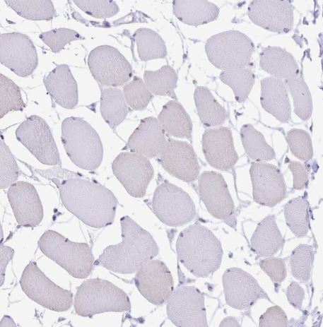 Transglutaminase 3/TGM3 Antibody