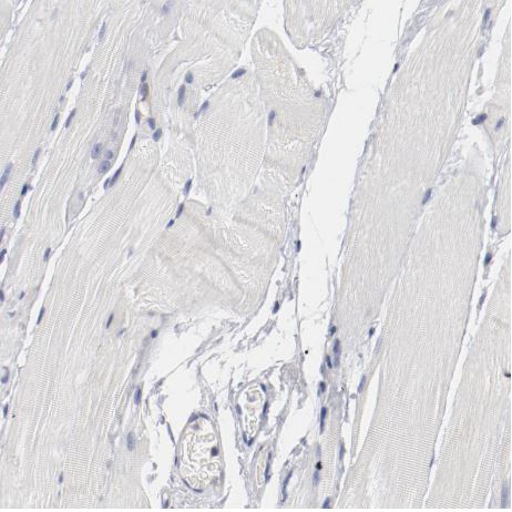 TSPAN6 Antibody