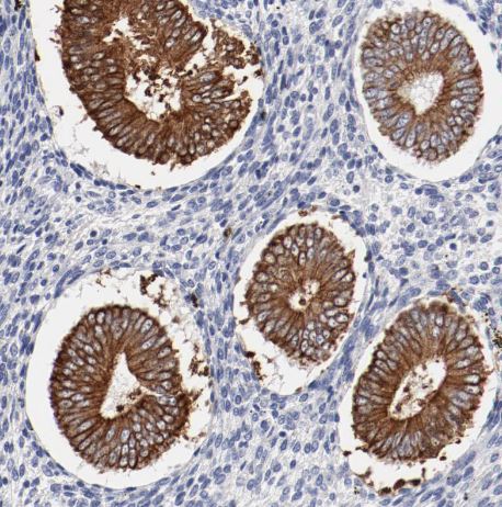 TSPAN6 Antibody