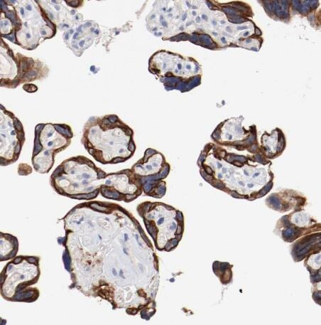 TSPAN6 Antibody