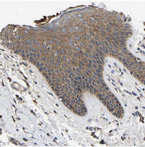 STAT2 Antibody
