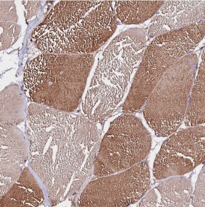 ST3 beta-Gal alpha-2,3-Sialyltransferase 1/ST3GAL1/SIAT4A Antibody - BSA Free