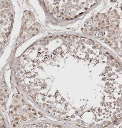 WRN Antibody