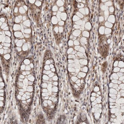 WRN Antibody