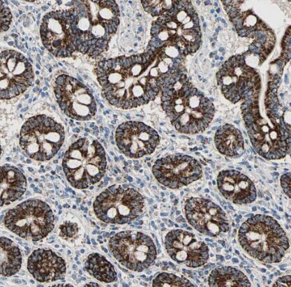 TST Antibody - BSA Free