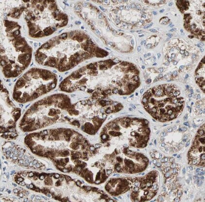 TST Antibody - BSA Free