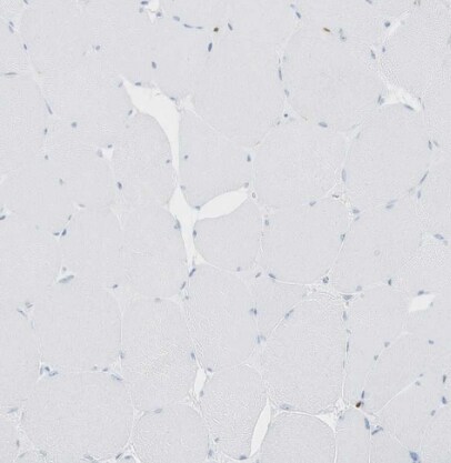 MNDA Antibody - BSA Free