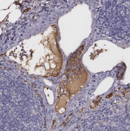 Transferrin Antibody