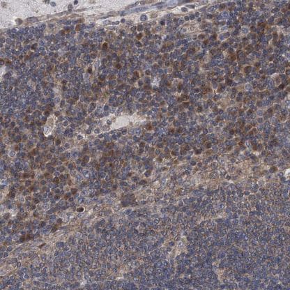 TJAP1 Antibody