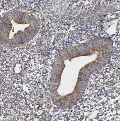 TJAP1 Antibody