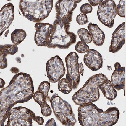 TJAP1 Antibody