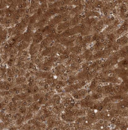 PNPO Antibody