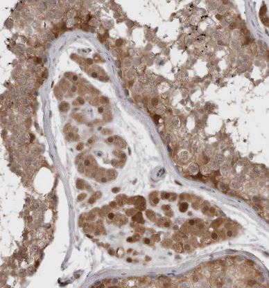 PNPO Antibody
