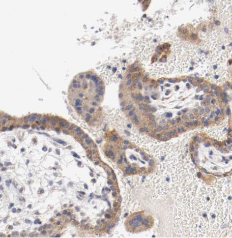 PACE4/PCSK6 Antibody
