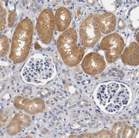 PACE4/PCSK6 Antibody