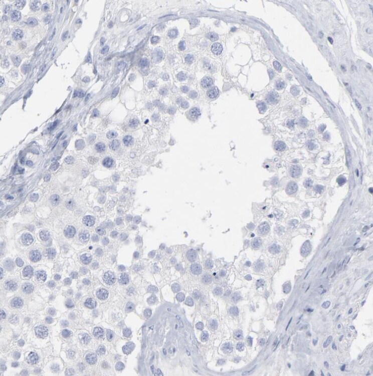 P2Y8 Antibody - BSA Free