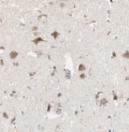 Nesfatin-1/Nucleobindin-2 Antibody