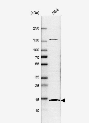 SF3B14 Antibody