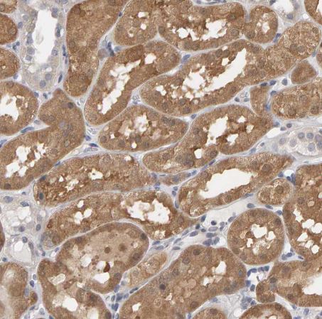 Methionine Sulfoxide Reductase A Antibody