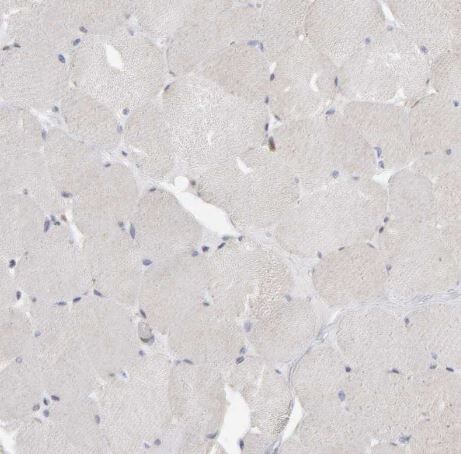 Methionine Sulfoxide Reductase A Antibody