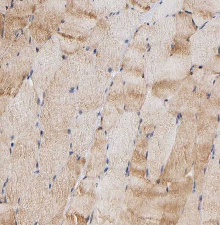 Aldolase A Antibody Aldolase A Antibody