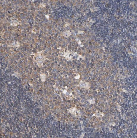 Aldolase A Antibody Aldolase A Antibody
