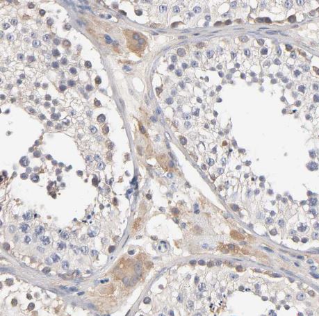 Aldolase A Antibody Aldolase A Antibody