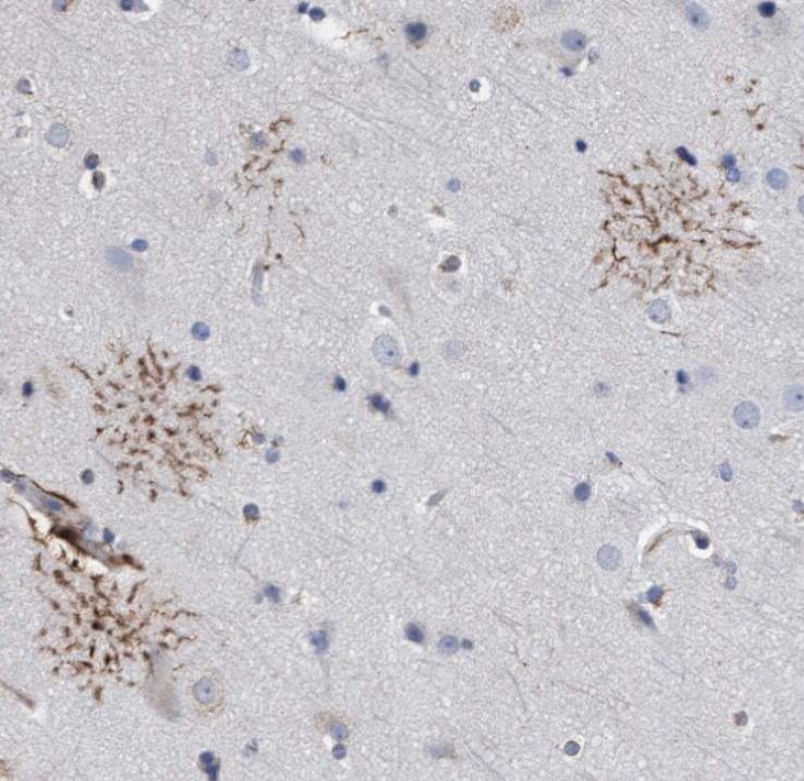 GPR39 Antibody - BSA Free