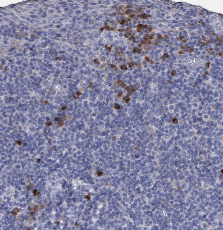 GPR39 Antibody - BSA Free