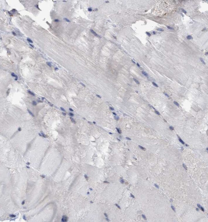 GPR39 Antibody - BSA Free