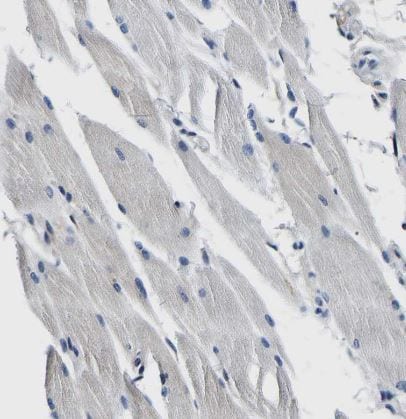 Aconitase 1 Antibody